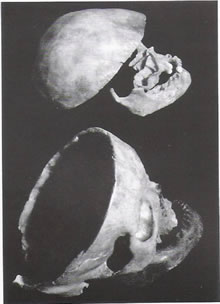 Crânes attribués à Louis XI en haut et à Charlotte de Savoie en bas